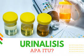 Check spelling or type a new query. Urinalisis Proses Metode Analisis Kenali Lebih Dalam Lewat Uraian Ini