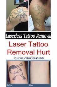 Was Kostet Die Entfernung Von Lasertattoos Tattoo Wie Viel Kostet Die Entfernung Von Lasertattoos An Tattoo Removal Cost Laser Tattoo Removal Laser Tattoo