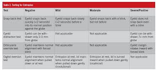 Image result for Entropion