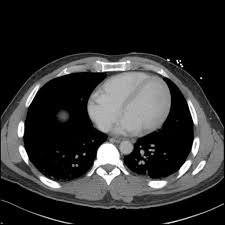 In some cases, physicians use all three imaging techniques. Ct Abdomen Pelvis Upper Axial Labeling Questions Radiology Case Radiopaedia Org