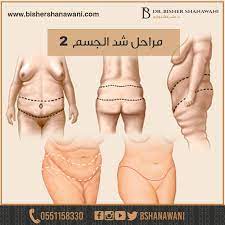 هناك أنواع مختلفة من شد الجسم التي تتوفر تبعا لمدى ترهل الجلد والدهون الزائدة خط البيكيني المستخدم لشد منطقة ترهلات البطن وا abs plastic surgery sport shoes
