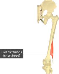The biceps femoris is one of the large muscles in the posterior compartment of the thigh and a component of the hamstrings. Biceps Femoris Short Head
