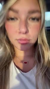 Jazmin Evans Need Kidney