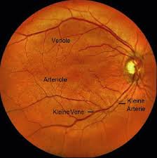Gefassanalyse An Der Retina