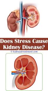 Learn about the symptoms and causes of kidney cancer and renal cell carcinoma. Pin On What Is Kidney Disease