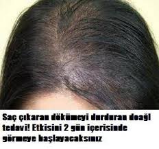 Kellige Son Sac Cikaran Dogal Kur Bayanlar Kahvesi Com Hair Cure Hair Loss Remedies Hair Loss Treatment