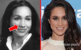 Meghan, duchess of sussex, урождённая рэ́йчел ме́ган маркл англ. Delo Ruk Mastera Kak Megan Vyglyadela Do I Posle Plastiki