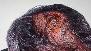 Güneş'in kafasına yabancı madde isabet etti, yerde kalan şenol güneş daha sonra soyunma odasına götürüldü. Senol Gunes Kafasi Yarildi Son Dakika Youtube