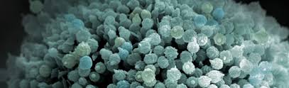 L'aspergillose est aussi une maladie infectieuse. Aspergilloses Definition Symptomes Et Traitements