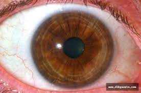 goz damarlari tikanikligi gorme kayiplarina yol acabilir