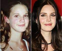 Lana del rey talks backlash, plastic surgery, and new album . Lana Del Rey Today On Twitter Lana Del Rey Has Done So Many Plastic Surgeries Http T Co Lqbjjfonfv