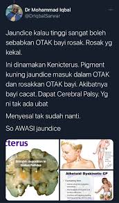We did not find results for: Demam Kuning Kalau Tinggi Boleh Rosakkan Otak Bayi Cacat Doktor Kongsi Bahaya Jaundice Pa Ma