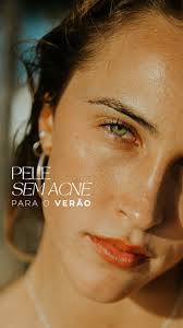 Pele sem acne para esse verão? , Veja as dicas da nossa doc  @robertaayresvolpe_dermato para você aproveitar esse fim de ano com  equilíbrio e sem acnes! , _______________________________, ✔️ Publicação ...