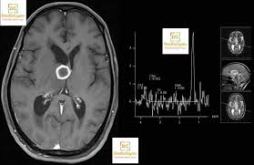 Pin By Radiogyan Radiology Made Eas On Spotters In 2020 Radiology Radiology Residency Radiography