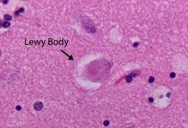 It is reported as the second most. Pin On Neuro System