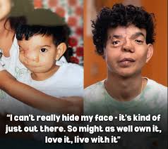 Man born with rare condition embraces his difference