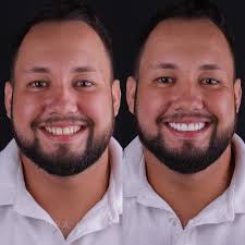 Dra. Danielle Oliveira (@dradanielleoliveiras) • Instagram photos and videos