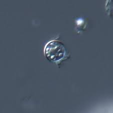 Image result for Cyclospora