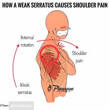 A common cause of shoulder pain is soreness of the tendon (a cord that attaches a muscle to a bone) in the rotator cuff. Shout Out To Pheasyque For Jarryd Pretorius Biokinetics Facebook
