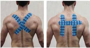 Kinesiology Tape For Postural Control American Journal Of Clinical Chiropractic Chiropractic Biophysics Amer Kinesiology Taping Kinesiology Kinesio Taping