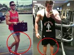 How Can One Fix Chicken Legs By Working Out? - Quora