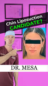 Double chin making you self-conscious? Let’s evaluate what’s really going 