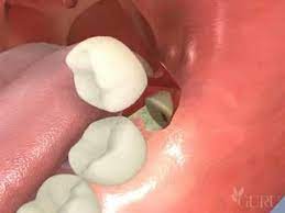 Pin On Affordable Dentistry Chennai