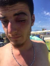 Eğlenmek için gittiği festivalde darp edildi!