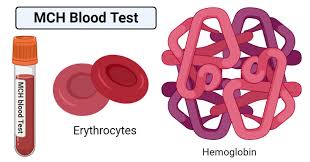 Mch Blood Test Definition Calculation Results High Low Mch Value
