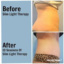 Pin On Red Light Therapy Low Laser