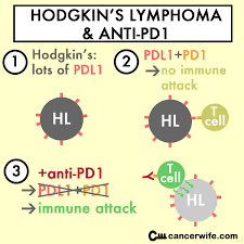 Why Anti Pd1 Works For Hodgkin S Lymphoma Http Cancerwife Com Content Anti Pd1 Immunotherapy Hodgkins L Immunotherapy Immunotherapy Cancer Hodgkins Lymphoma