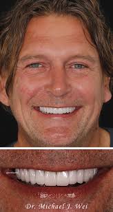 Best Manhattan Cosmetic Dentist in NYC