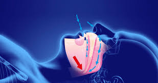 Apnea del sueño ¿qué es y cómo se trata? - Clínica Fernández Abarca