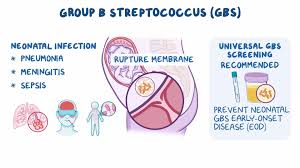 Image result for Group B Streptococcus Prophylaxis