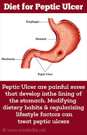 Pylori infection, foods that are rich in antioxidants may be beneficial. Diet For Peptic Ulcer Stomach Ulcers What To Eat And What Not To Eat