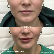 Holly Tabor, MS, APRN, FNP-C