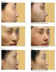 If you are a plastic surgeon, or operating any other form of business in malaysia or. Jk Jk Plastic Surgery Consultation Centre Penang Malaysia Facebook