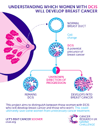Eating when you have nausea and vomiting almost all breast cancer treatments have varying degrees of risk for nausea and vomiting. Preventing Unnecessary Breast Cancer Treatment Cancer Research Uk Cancer News
