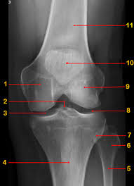 For more anatomy content please follow us and visit our website: Knee Ap View Radiology Reference Article Radiopaedia Org