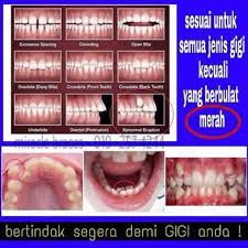 Yang nak baca ni aku syorkan pada yang tak pakai braces lagi, sebab yang. Teeth Trainer Braces Retainer Combo Deal Soft Hard Readystock Malaysia Shopee Malaysia