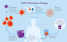 NexCAR19: India's First Indigenous CAR T- Cell Therapy for Cancer -  Civilsdaily