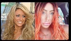 Danity kane star aubrey o'day, has been facing plastic surgery accusations for some months now. Aubrey O Day Before And After R Exonthebeach