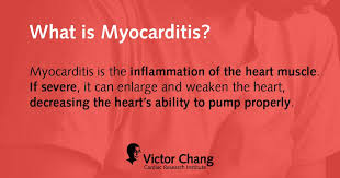 Image result for Myocarditis