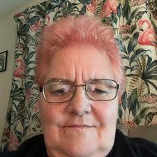 Is it normal to have osteoarthritis issues down one side. I have shoulder,  elbow, hip and knee