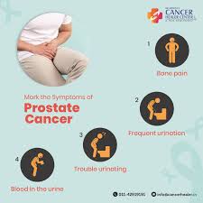 Because most people don&#x27;t experience symptoms, the u.s. Cancer Healer Prostate Cancer Symptoms Are Not Apparent Facebook