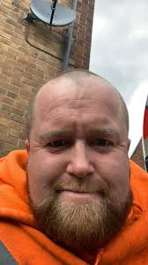 Thinking about going turkey to get a hair transplant, wanna know what it  might look like with hair? Thanks👍🏼