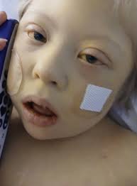 My dad has been cleared to be put