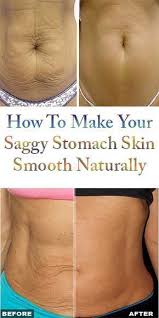How To Make Your Saggy Stomach Skin Smooth Naturally Smooth Skin Loose Skin Sagging Skin