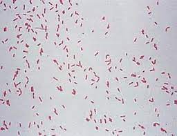 What diseases are caused by pseudomonas aeruginosa? Gram S Staining Result Of Small Rod Gram Negative Pseudomonas Download Scientific Diagram