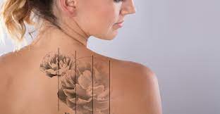 Maybe you would like to learn more about one of these? Tattoo Removal Orlando Fl The Institute Of Aesthetic Surgery